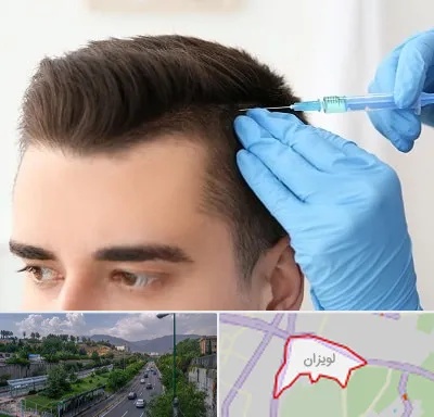 مزوتراپی مو در لویزان