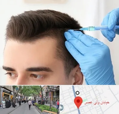 مزوتراپی مو در ولیعصر شهریار