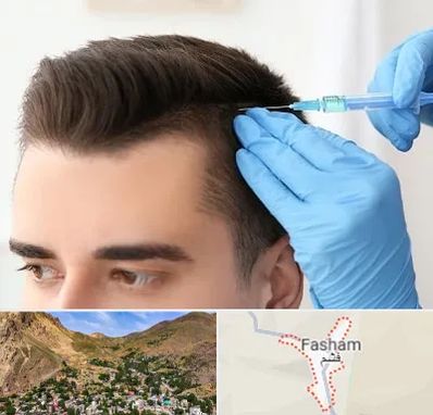 مزوتراپی مو در فشم