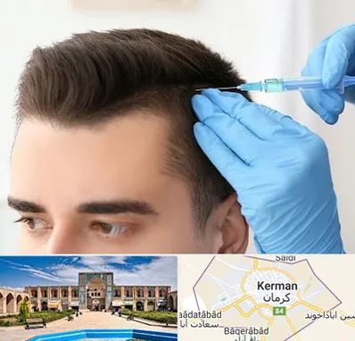 مزوتراپی مو در کرمان