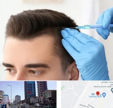 مزوتراپی مو در چهارراه طالقانی کرج