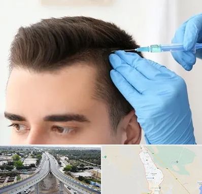 مزوتراپی مو در اندیمشک