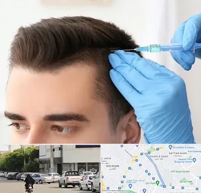 مزوتراپی مو در قدوسی شرقی شیراز