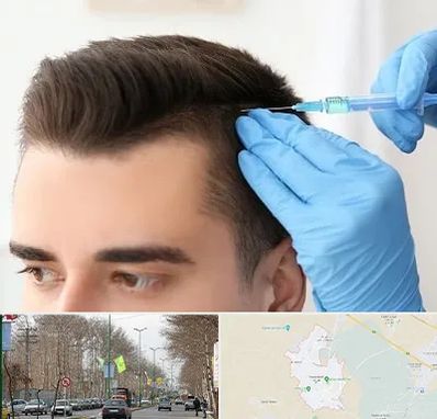 مزوتراپی مو در نظرآباد کرج