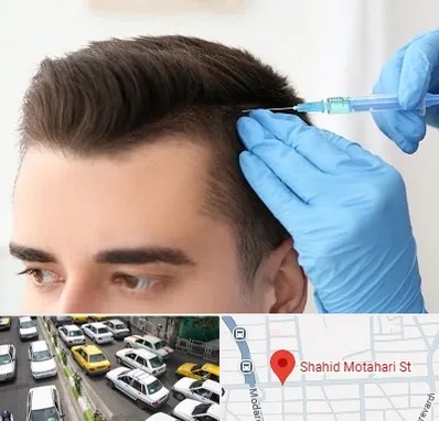 مزوتراپی مو در مطهری تهران