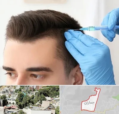 مزوتراپی مو در جماران