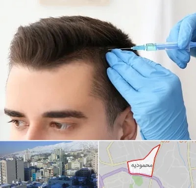 مزوتراپی مو در محمودیه
