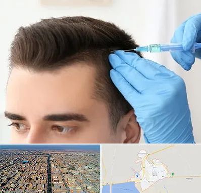 مزوتراپی مو در بندر ماهشهر