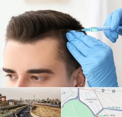 مزوتراپی مو در جوادیه