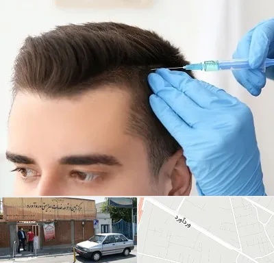 مزوتراپی مو در وردآورد