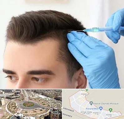 مزوتراپی مو در پرند