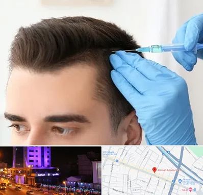 مزوتراپی مو در آبرسان تبریز