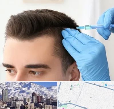 مزوتراپی مو در ازگل