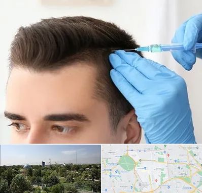 مزوتراپی مو در منطقه 16 تهران