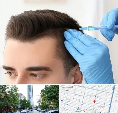 مزوتراپی مو در امامت مشهد