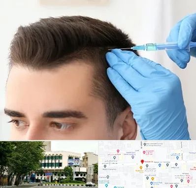 مزوتراپی مو در طالقانی