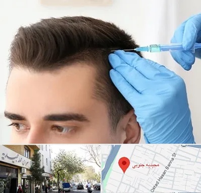 مزوتراپی مو در مجیدیه جنوبی