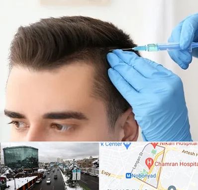 مزوتراپی مو در اقدسیه