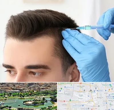 مزوتراپی مو در منطقه 9 تهران