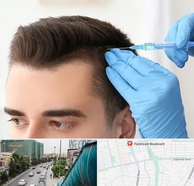 مزوتراپی مو در بلوار فرحزادی