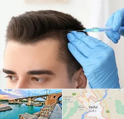 مزوتراپی مو در دزفول