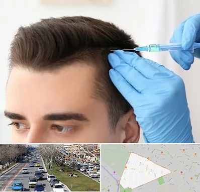 مزوتراپی مو در احمدآباد مشهد