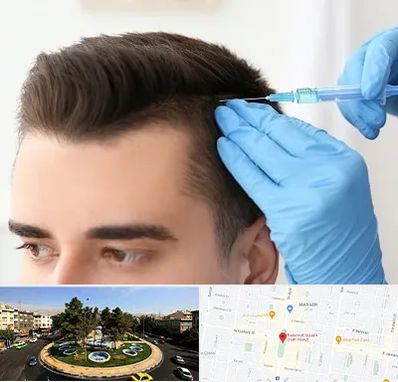 مزوتراپی مو در هفت حوض