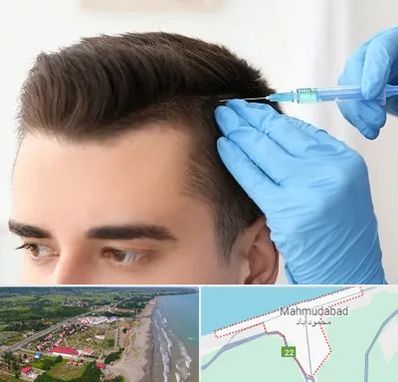 مزوتراپی مو در محمودآباد