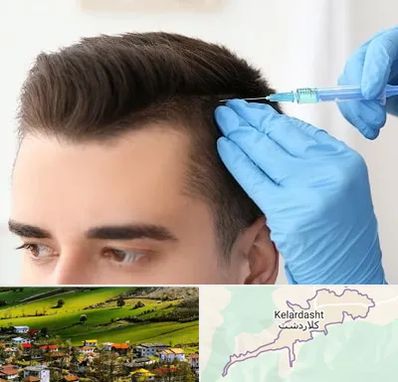 مزوتراپی مو در کلاردشت