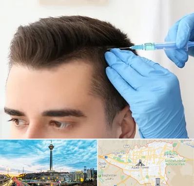مزوتراپی مو در تهران