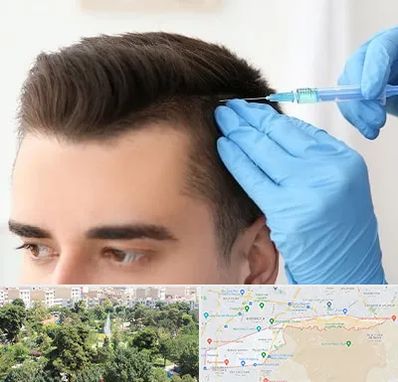 مزوتراپی مو در منطقه 13 تهران