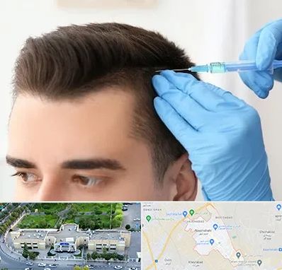 مزوتراپی مو در نسیم شهر