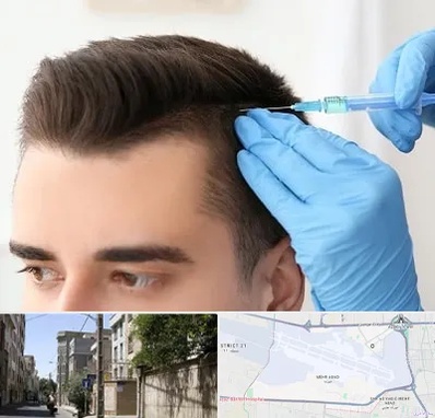 مزوتراپی مو در مهرآباد