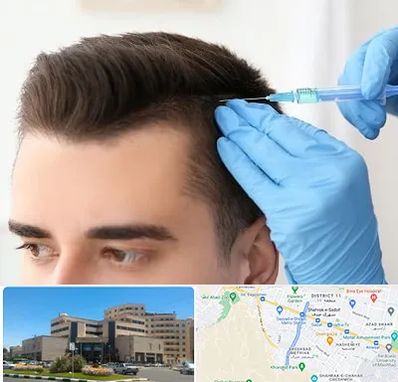 مزوتراپی مو در صیاد شیرازی مشهد