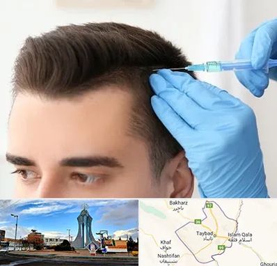 مزوتراپی مو در تایباد