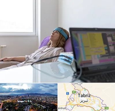 بیوفیدبک در تبریز