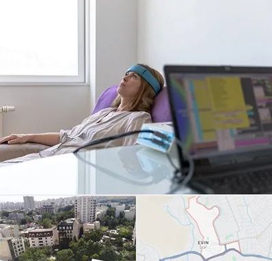 بیوفیدبک در اوین