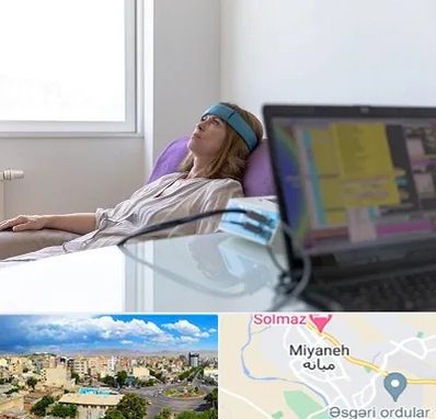 بیوفیدبک در میانه