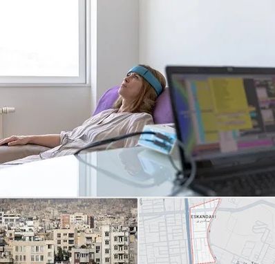 بیوفیدبک در اسکندری