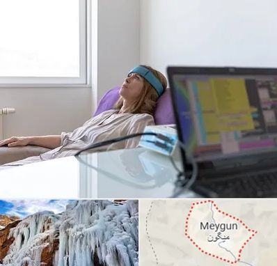 بیوفیدبک در میگون