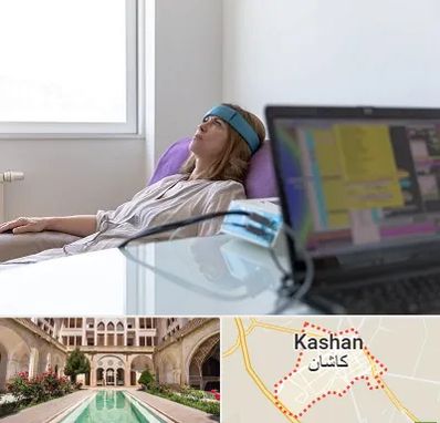 بیوفیدبک در کاشان