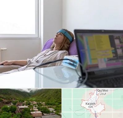 بیوفیدبک در کلاله