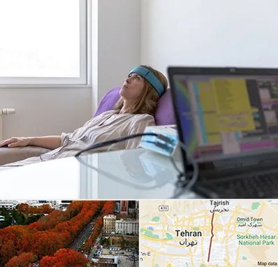 بیوفیدبک در ولیعصر