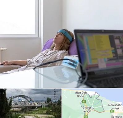 بیوفیدبک در چالوس