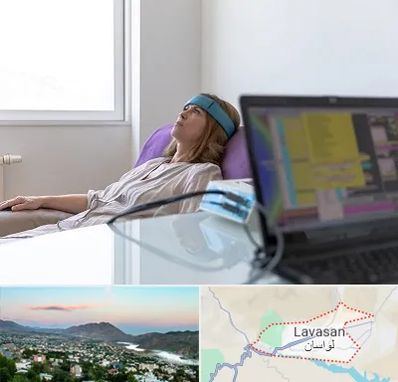 بیوفیدبک در لواسان