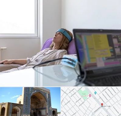 بیوفیدبک در مصلی مشهد