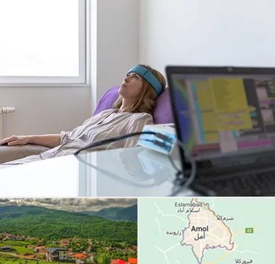 بیوفیدبک در آمل