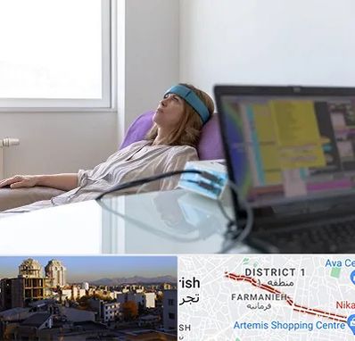 بیوفیدبک در فرمانیه