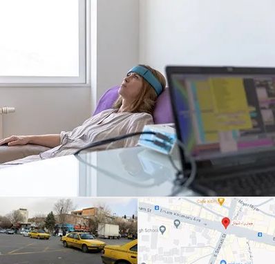 بیوفیدبک در شهناز تبریز