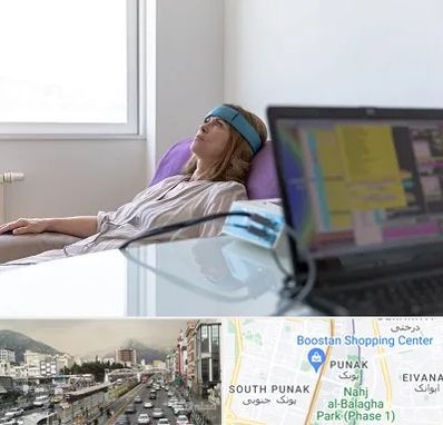 بیوفیدبک در پونک